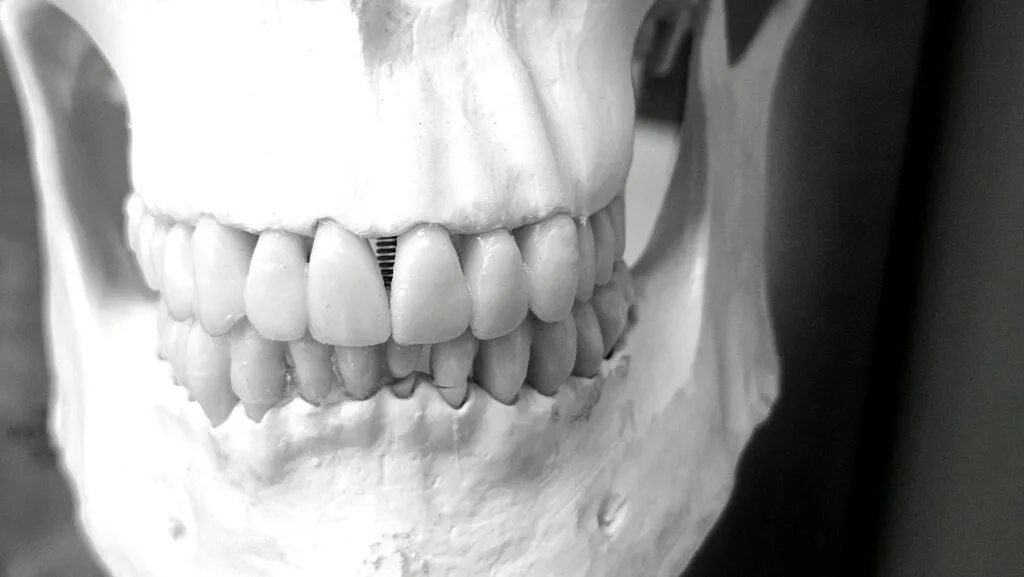 study dentistry in spain