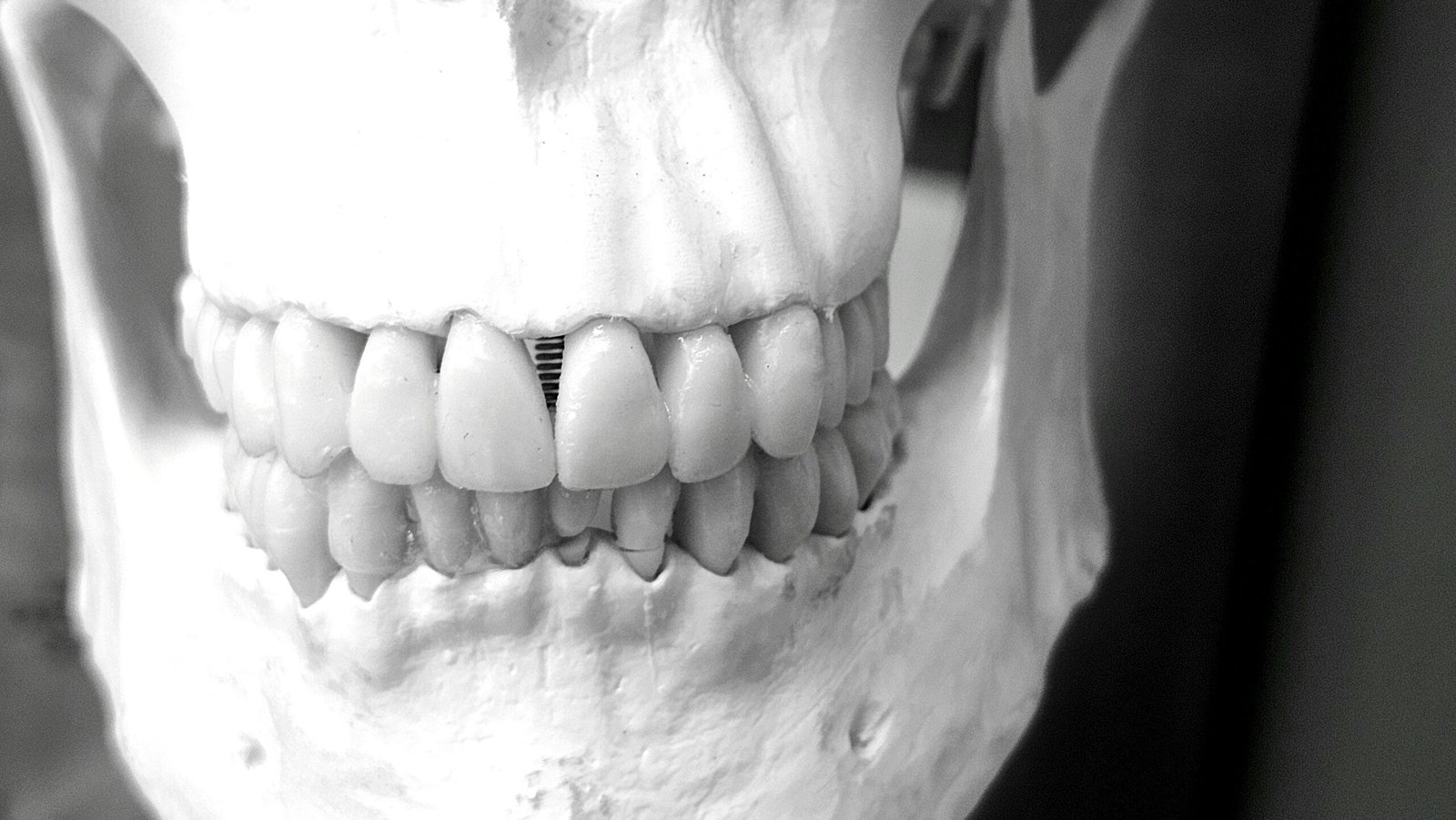 study dentistry in spain